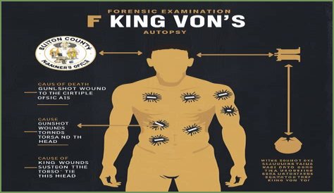 Discover The Shocking Truth: King Von's Autopsy Photos Revealed